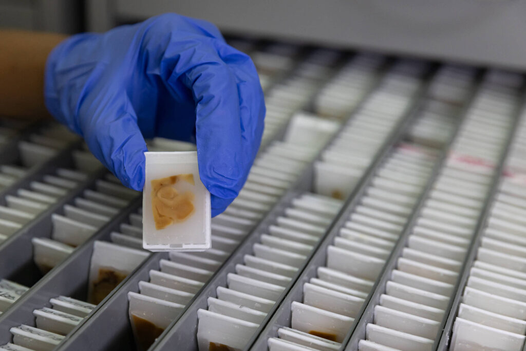 Estudo da USP vê ligação entre álcool e risco de demência - 09/04/2025 - Equilíbrio e Saúde